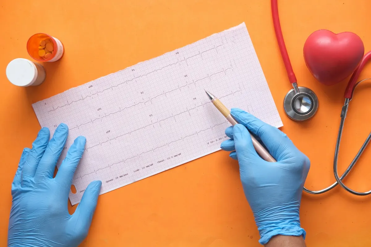 Profesional con guantes revisando el trazado de un electrocardiograma